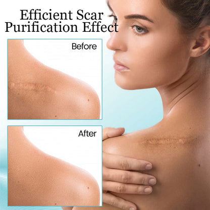 Ceoerty™ Skin Renewal Scar Spray