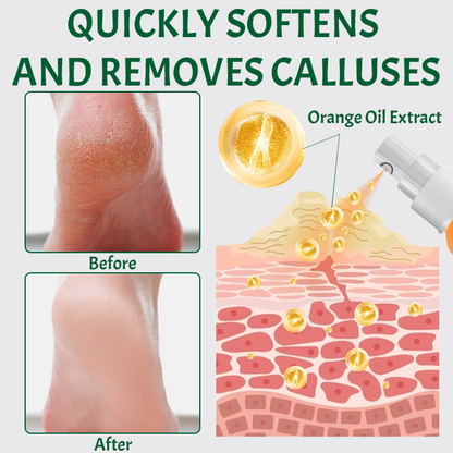 Ceoerty™ SmoothFeet Callus Remover Spray