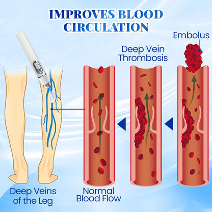 Biancat™ Blue Light Therapy Set for Varicose Veins