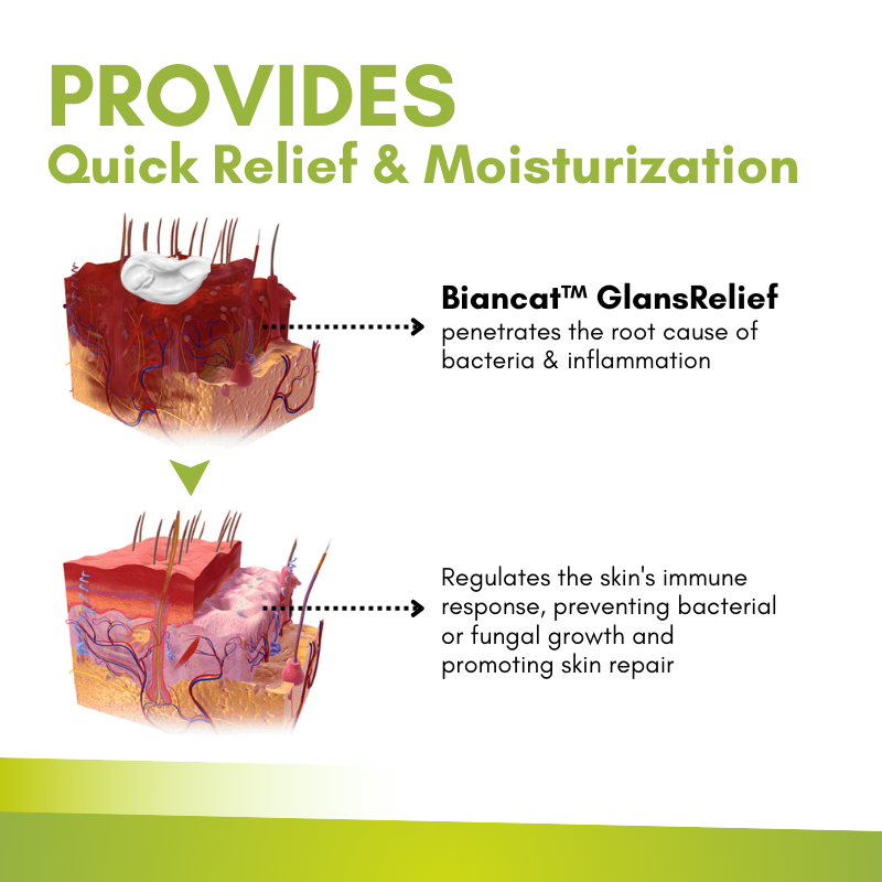 Biancat™ GlansRelief Anti-Inflammation Cream