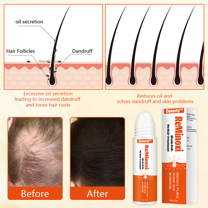 Ceoerty™ ReMinoxi-Biotin Roll-On Hair Treatment