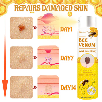 Biancat™ Bee Venom Wart Care Spray