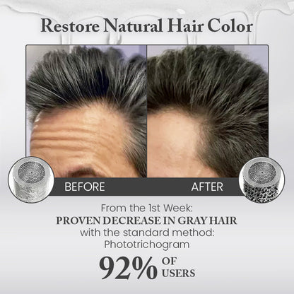 Ceoerty™ Anti-Gray Hair Serum